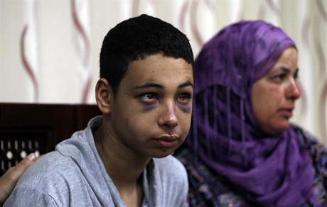 Patnáctiletého Palestince Tárika abú Chudajra, bratrance upáleného Muhammada,...