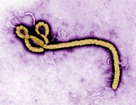 Charakteristický tvar viru ebola.