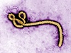Charakteristický tvar viru ebola.
