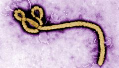 Charakteristický tvar viru ebola. | na serveru Lidovky.cz | aktuální zprávy