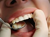 Zubař (ilustrační foto)