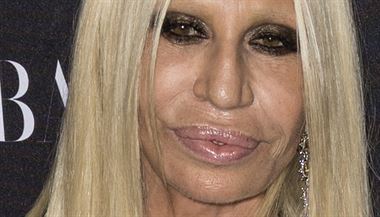 Mdn nvrhka Donatella Versace to splastikami pehn. Botoxov injekce a...