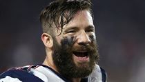 astn vtz. Julian Edelman rozdval krtce po utkn smvy.