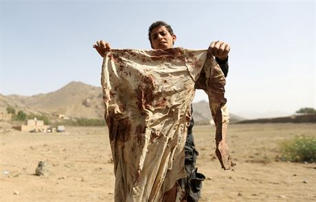 Chlapec ukazuje odv potsnn krv nedaleko jemenskho hlavnho msta San.