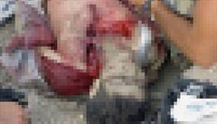 Zranný Omar Khadr v péi amerických medik.