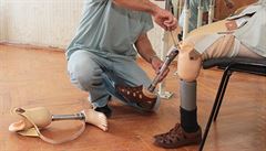 Rakušané vyvinuli nožní protézu, která umožní cítit povrch