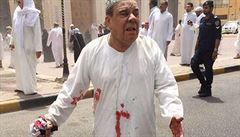 Zranný mu po útoku v Kuvajtu.