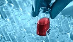 Britští vědci vyvinuli nové zařízení pro test na přítomnost HIV
