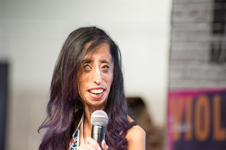 Lizzie Velásquezová