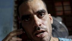 Umělec 'El Sexto' na svobodě. Kuba propustila posledního politického vězně