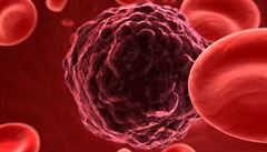 Čeští vědci objevili další gen, co způsobuje metastáze u nádorů 