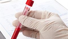 Vědci objevili genetickou nemoc krve, zvyšuje riziko leukémie