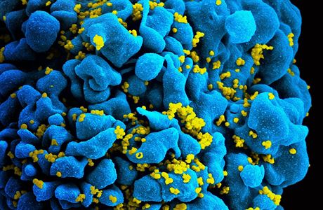 T-lymfocyt napadený virem HIV.