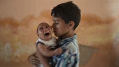 Děti se zakrnělou hlavou. Virus mrzačící novorozence zaskočil Latinskou Ameriku