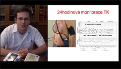 Videop�íru�ka poradí, jak si správn� a p�esn� zm��it krevní tlak.