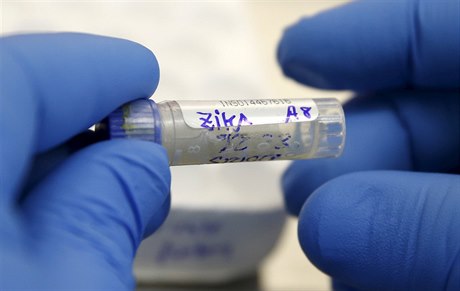 O viru zika vědci stále nemají dostatek znalostí.