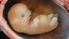 Čína zastavila práci vědců, kteří modifikovali lidská embrya