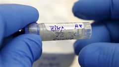 Živý zika virus ve spermatu přežívá až 14 dní, říká viroložka