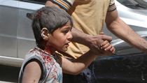Bombardovn Aleppa: zrann chlapec.