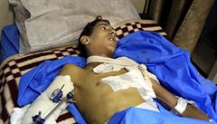 Patnáctitelý Sattar Jabbar, ob bombového útoku v Bagdádu. Stet s...