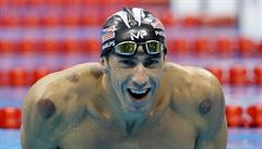 Michael Phelps se stopami po bakování.