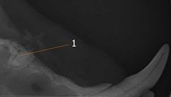 Retence zubního koene spodní elisti. Bez intraorálního RTG snímku by nebylo...
