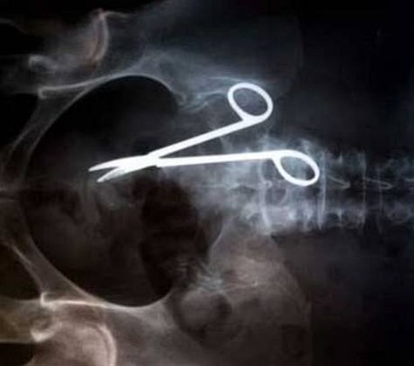 Nůžky v žaludku - ilustrační foto.