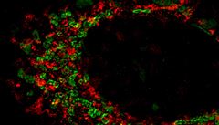 Oncoprotein Her2 (ervená barva) je lokalizován v mitochondriích (zelená barva)...