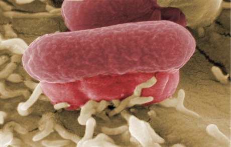 Bakterie E coli pod mikroskopem