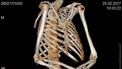 Snímek kostry mumie barona Trencka