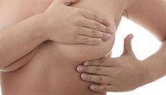 Počet žen, které onemocní rakovinou prsu, každoročně narůstá.