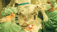 Prvn transplantace tve ve panlsku ukonila 11let trpen mue 