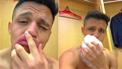 VIDEO: Au, mám bebí, ukazoval hvězdný Sanchez z Arsenalu. Fanoušci se mu vysmívají