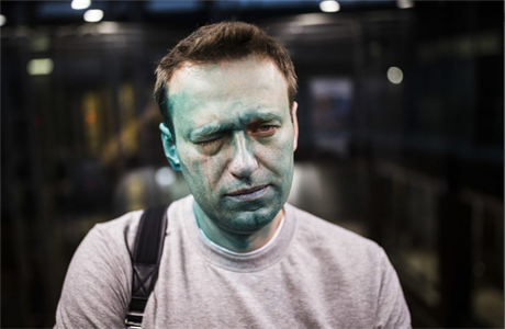 Rusk aktivista Alexej Navalnyj po toku chemikli
