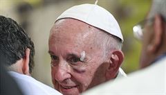 Zranný pape Frantiek.