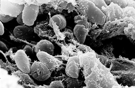 Bakterie Yersinia pestis zpsobující mor.