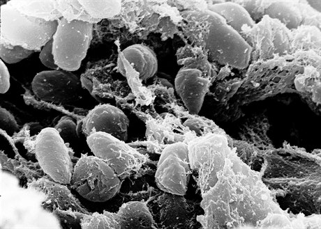 Bakterie Yersinia pestis způsobující mor.