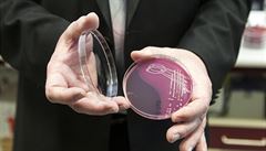 Olomoučtí vědci umí zrušit odolnost bakterií vůči nanostříbru