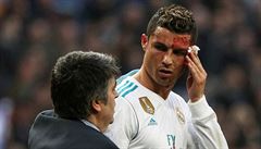 Cristiano Ronaldo si utírá krvavý rám na oboí.