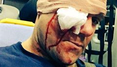 Zranný wrestler Eddie Edwards.