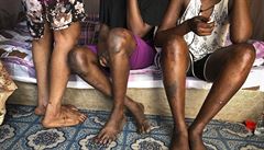 Nohy tí en z Jiního Súdánu, které jsou sexuální otrokyn.