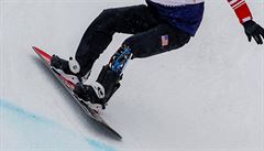 Paralympik Mike Schultz utrpl pi pádu ve snowcrossu mnohonásobné zlomeniny v...