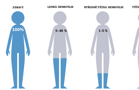 Procentuln ptomnost srecch faktor v souvislosti se zvanost hemofilie.