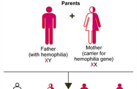 Procentuln ptomnost srecch faktor v souvislosti se zvanost hemofilie.