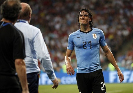 MS ve fotbale 2018, Uruguay vs. Portugalsko: zranný Edison Cavani.