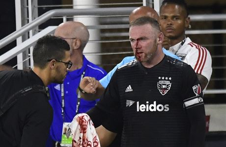 Wayne Rooney dohrál zápas i se zlomeným nosem.