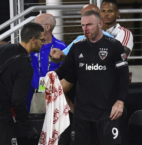 Wayne Rooney dohrál zápas i se zlomeným nosem.