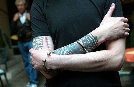 Tetování nejlíp odstraní laser, jeho paprsek rozbije pigment | Zdraví |  Lidovky.cz