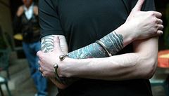 Tetování nejlíp odstraní laser, jeho paprsek rozbije pigment