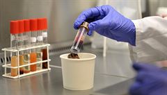 Ve Francii zaznamenali první nákazu novým koronavirem, podobá se SARS